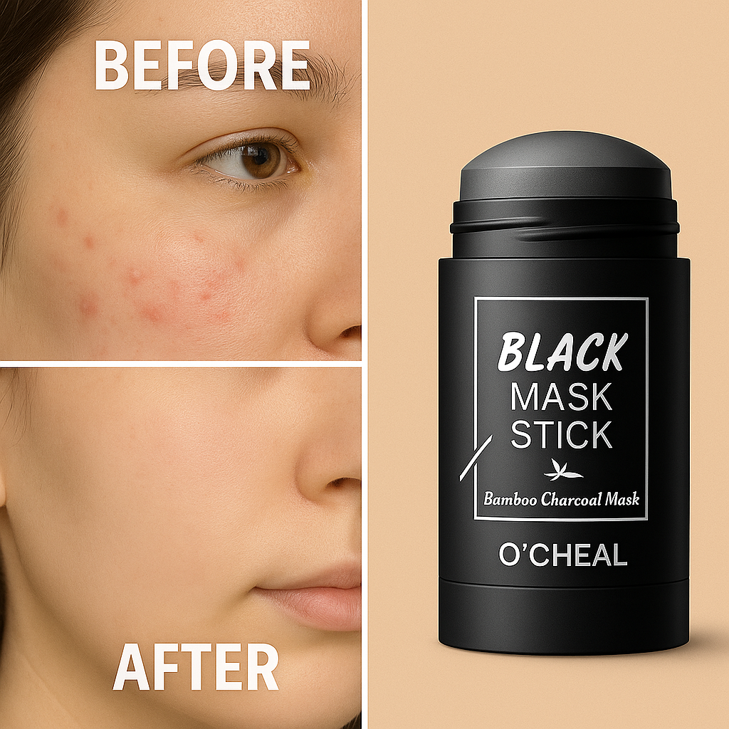 😟 Your Skin Problems Aren’t Just “Normal” — They’re Holding You Back